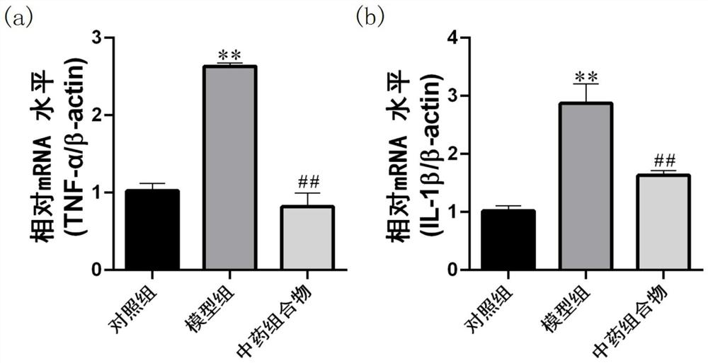 Traditional Chinese medicine composition for treating acute pancreatitis and application thereof