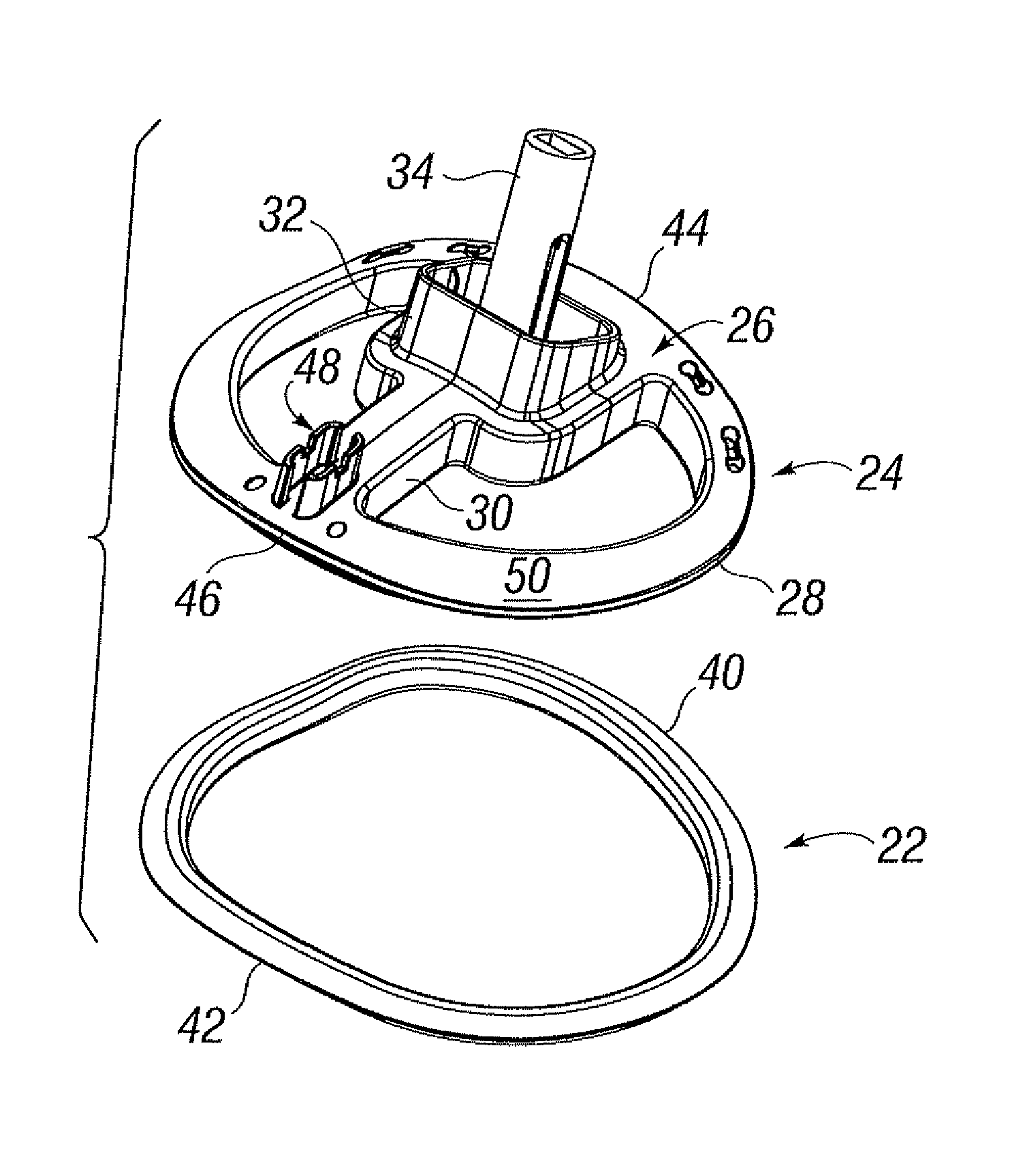 Quick-release annuloplasty ring holder