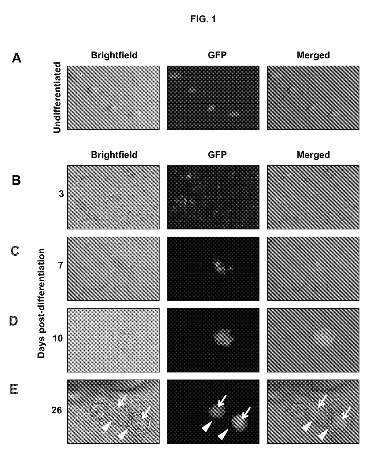 Methods for growth and maturation of ovarian follicles