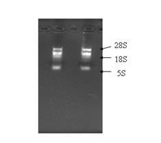 Rice disease resistance related gene, encoding protein thereof and preparation method for strain for improving rice broad spectrum disease resistance