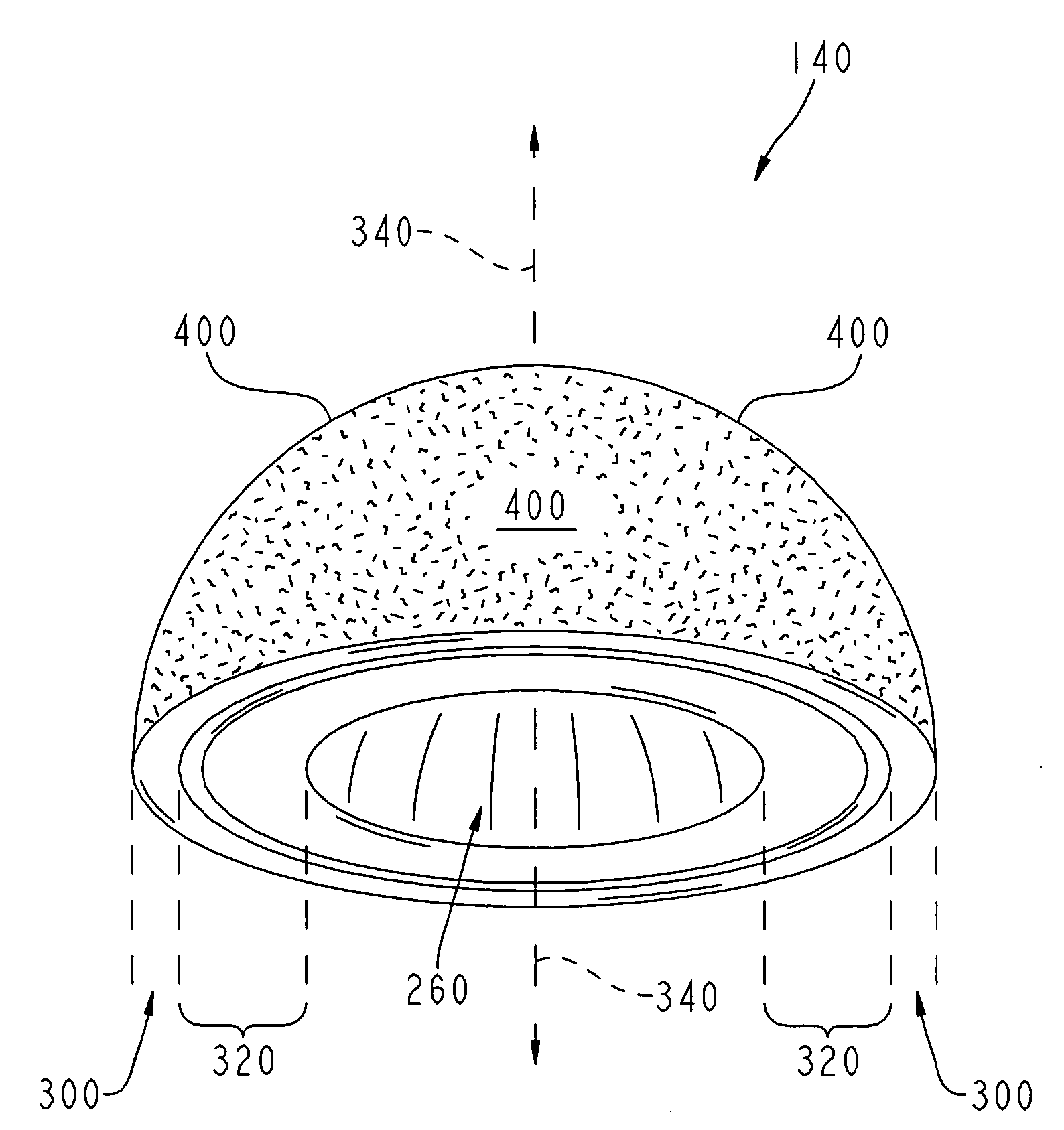 Method for making a metal-backed acetabular implant