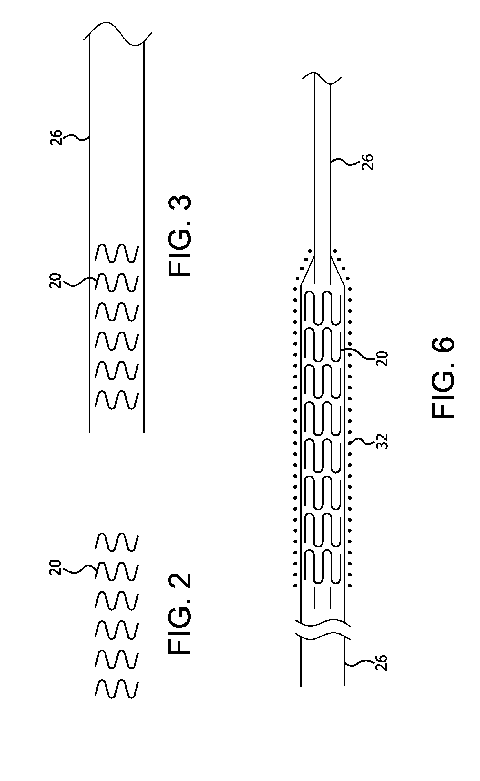 Implantable medical device constraint and deployment apparatus