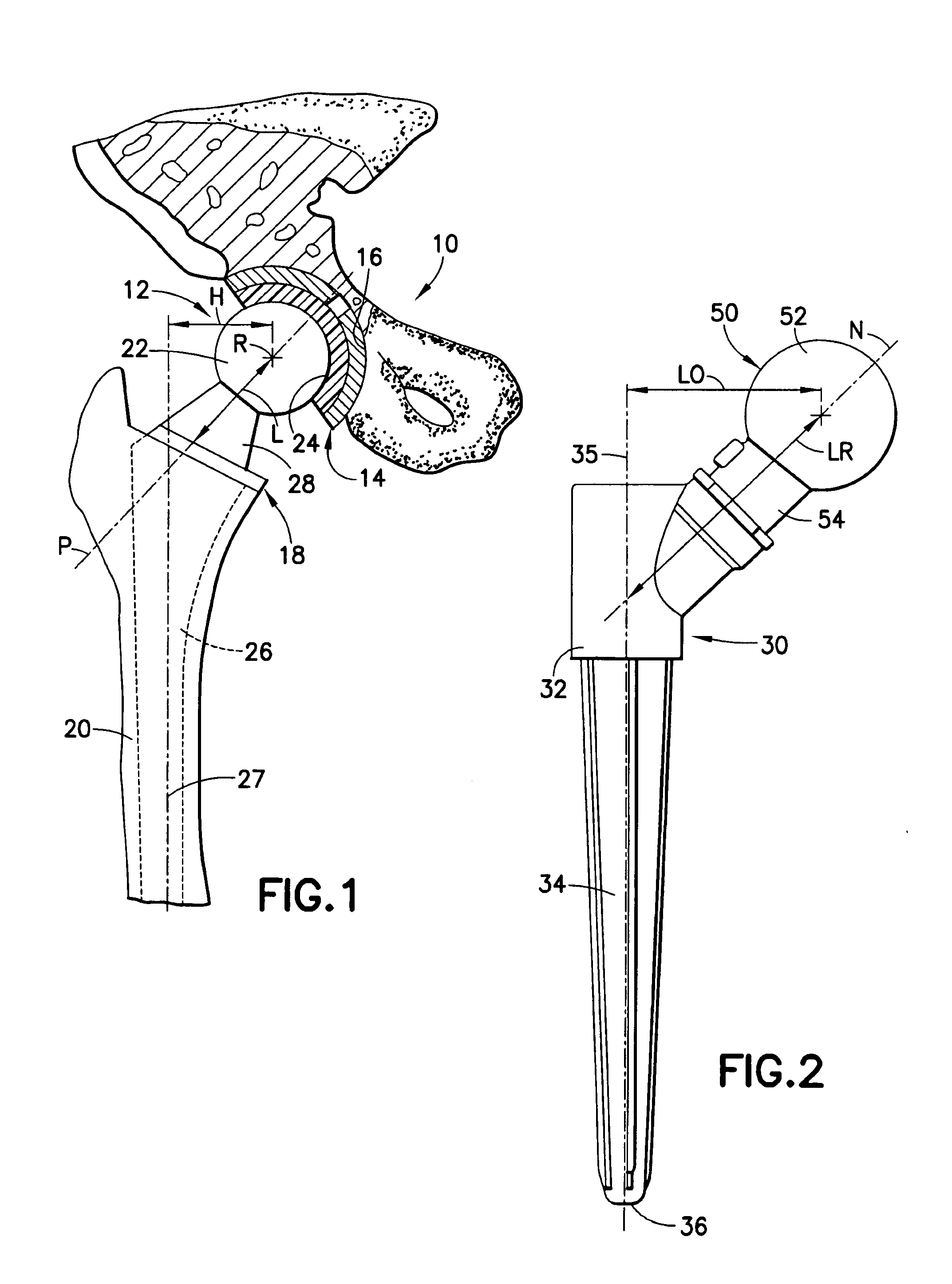Hip arthroplasty trialing apparatus with adjustable proximal trial and method