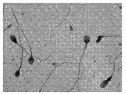 Sperm morphology anomaly detection method