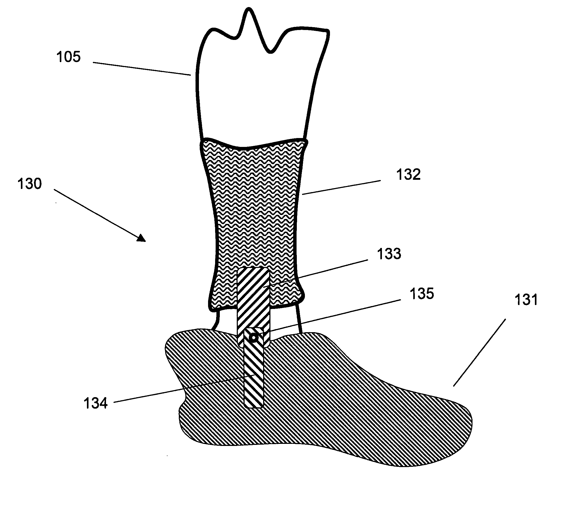 Methods and devices for selective exercising of muscles