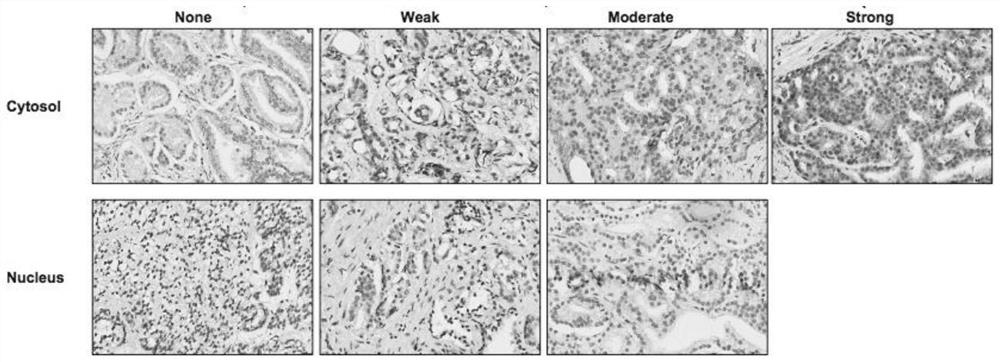 Application of substances that induce irf8 expression in the preparation of drugs for treating liver cancer