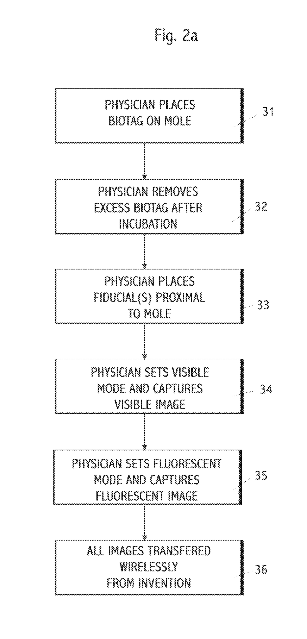 System for imaging lesions aligning tissue surfaces