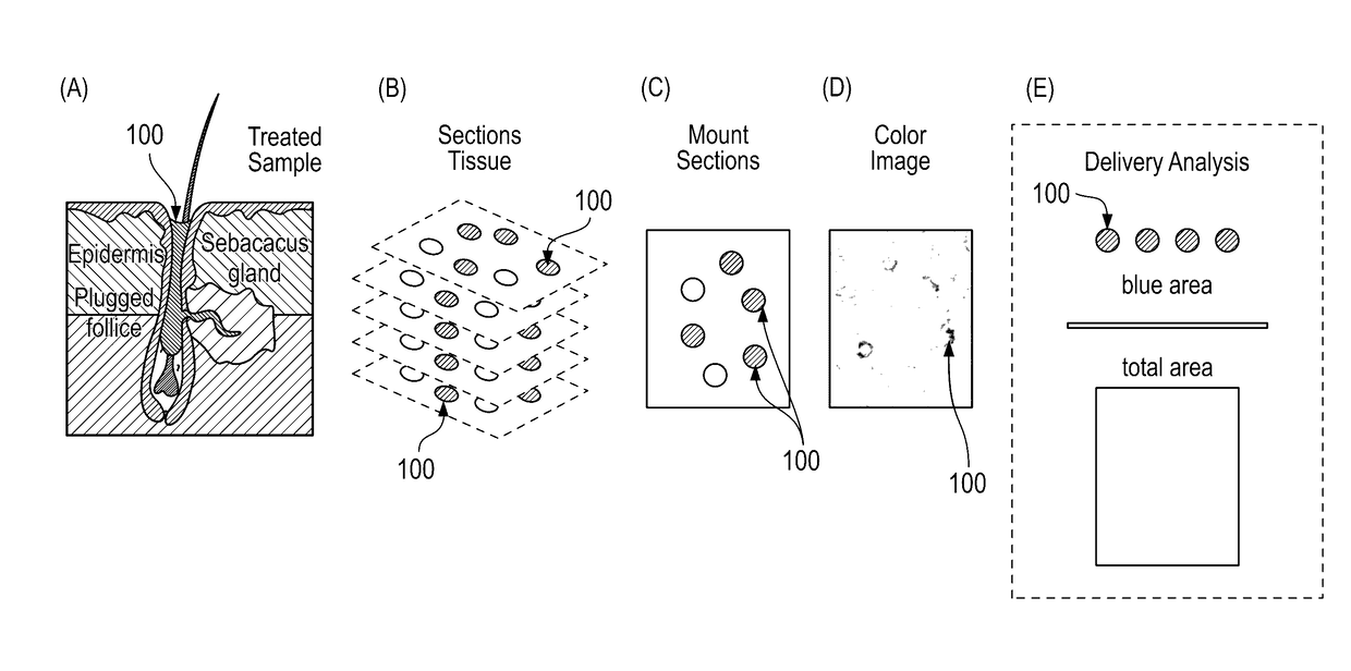 Ultrasound delivery of nanoparticles