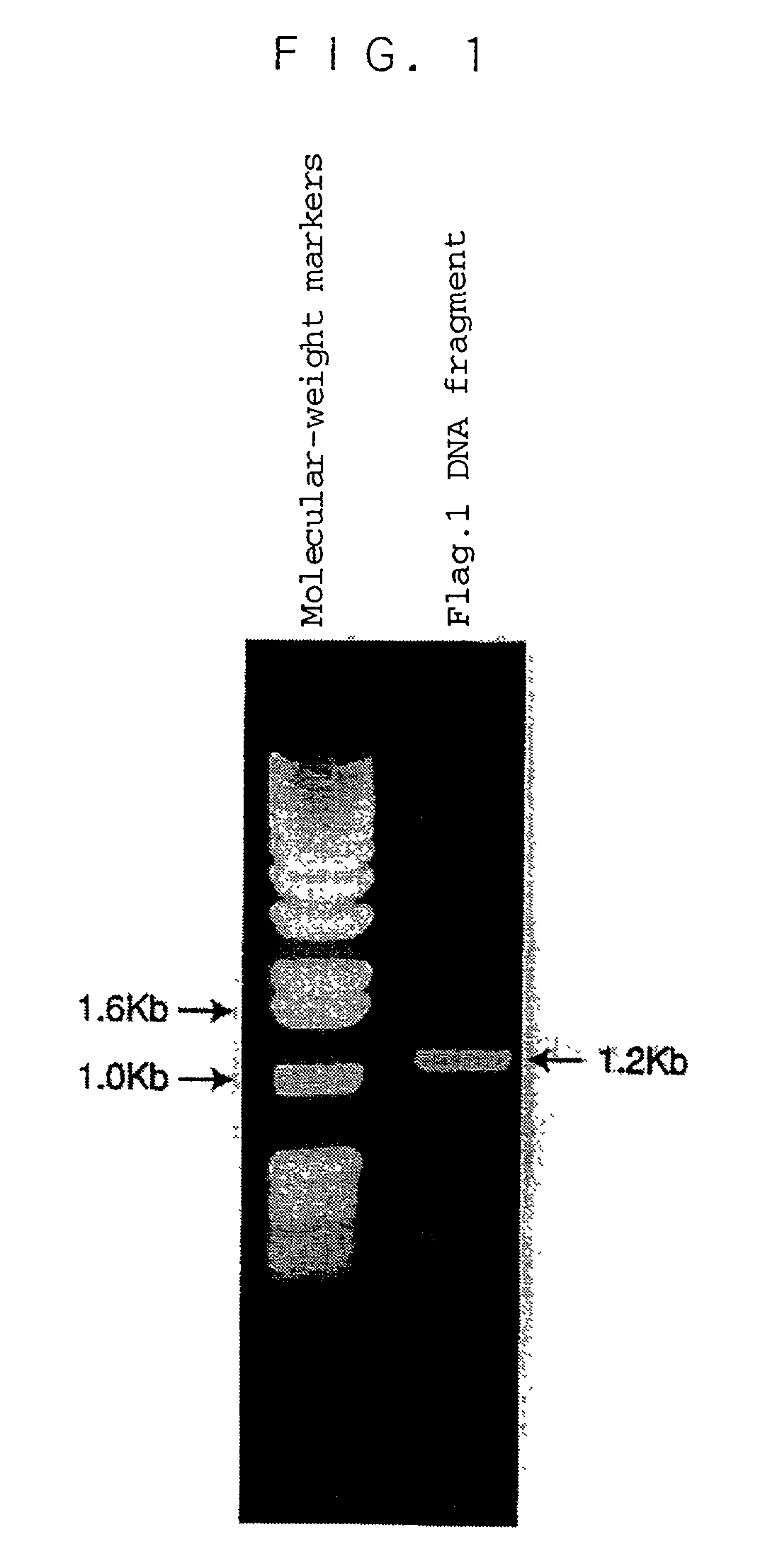 Human ADAMTS-1 protein, gene encoding the same, pharmaceutical composition, and method for immunologically analyzing human ADAMTS-1 protein