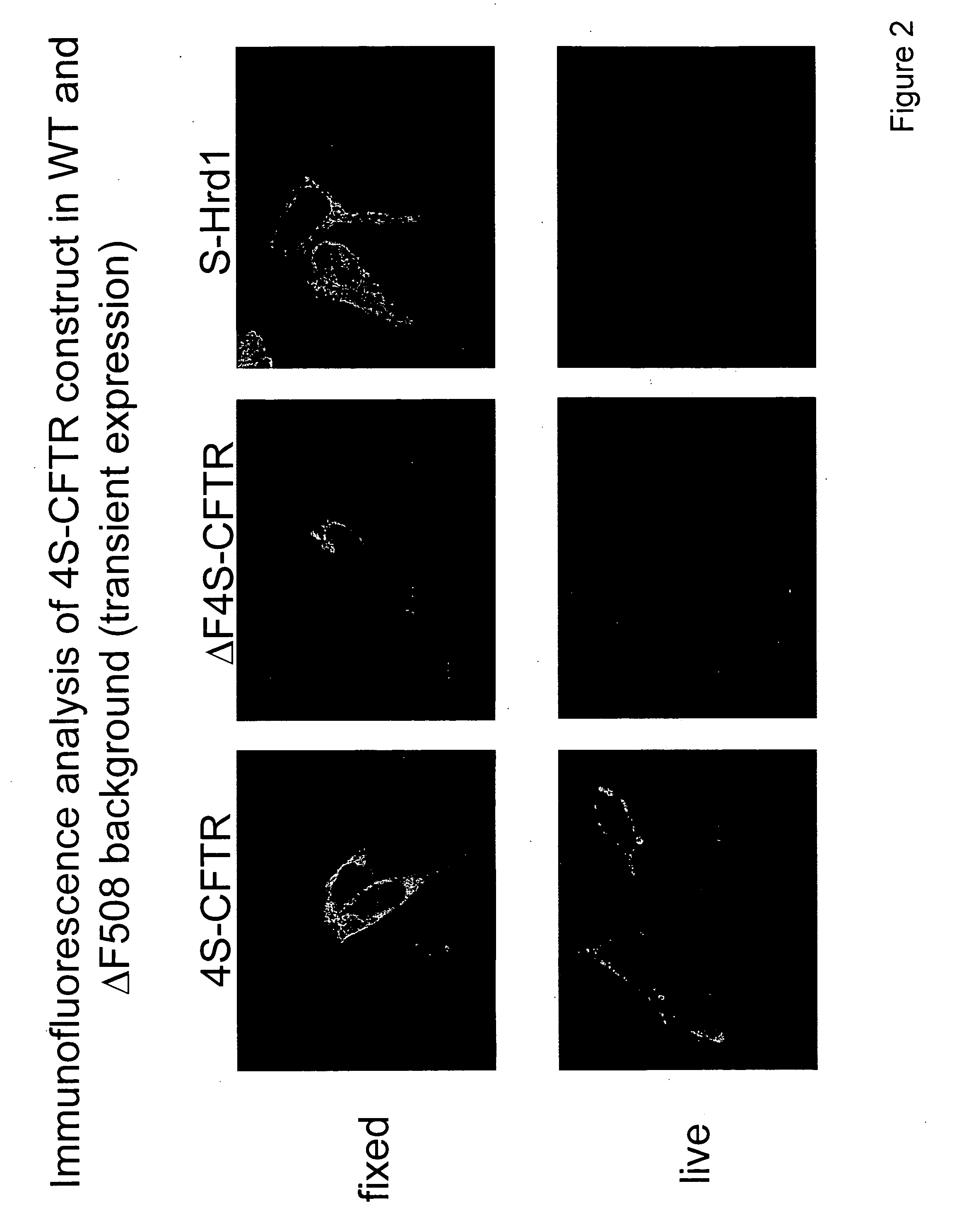 Compositions and methods for high throughput screening of pharmacological chaperones