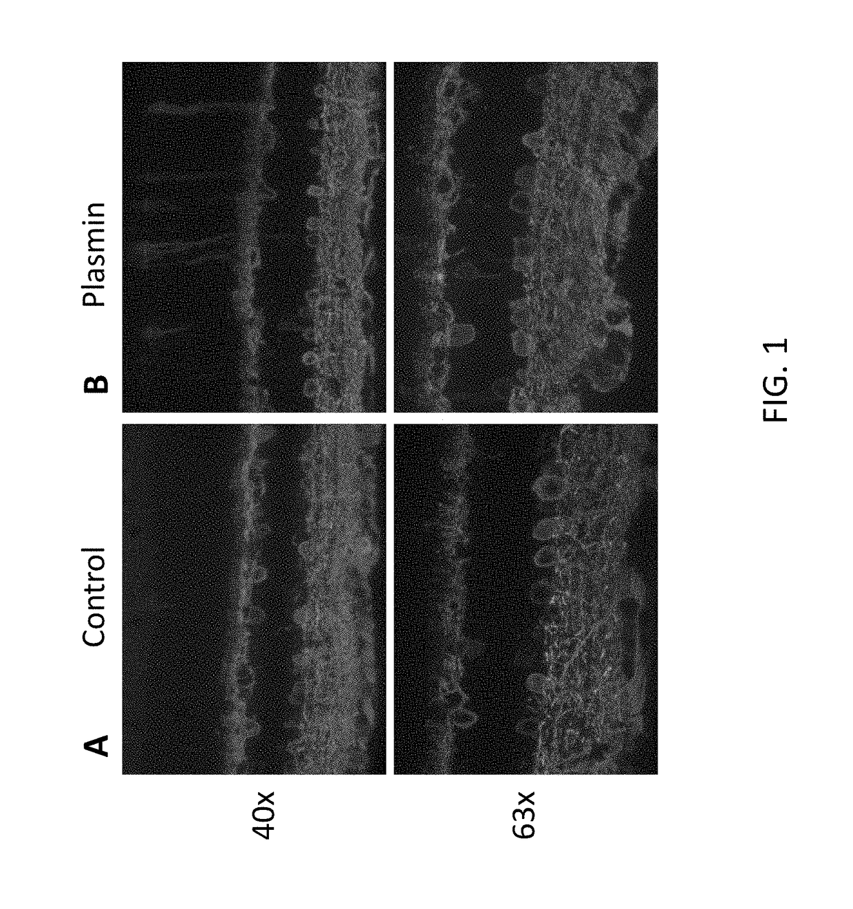 Method of Enhancing Delivery of Therapeutic Compounds to the Eye