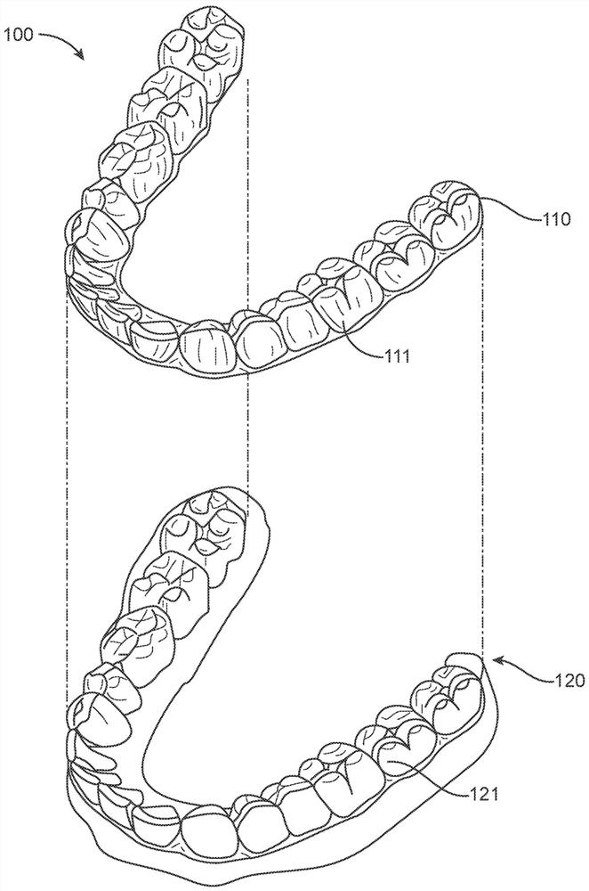 System, method and device for correcting malocclusion