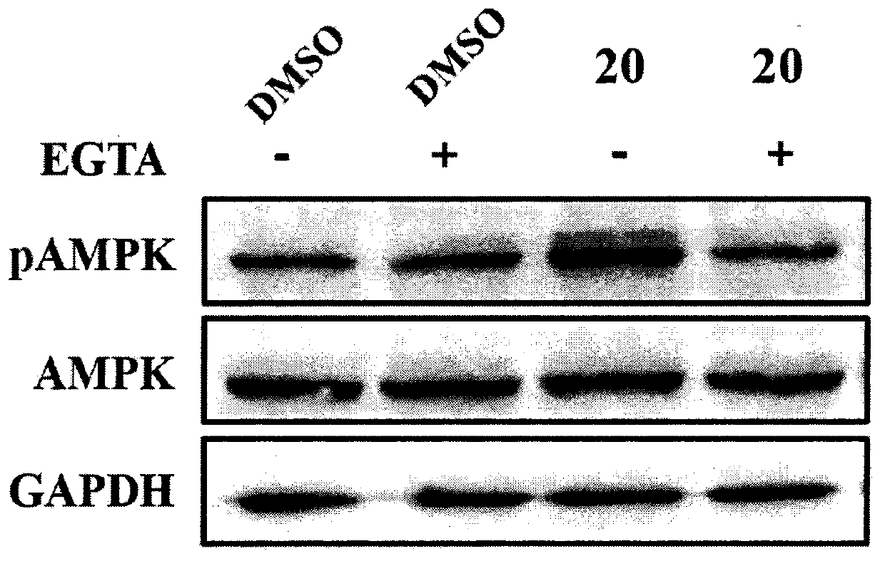Piperazine adenosine monophosphate activated protein kinase (AMPK) agonist and medical application thereof