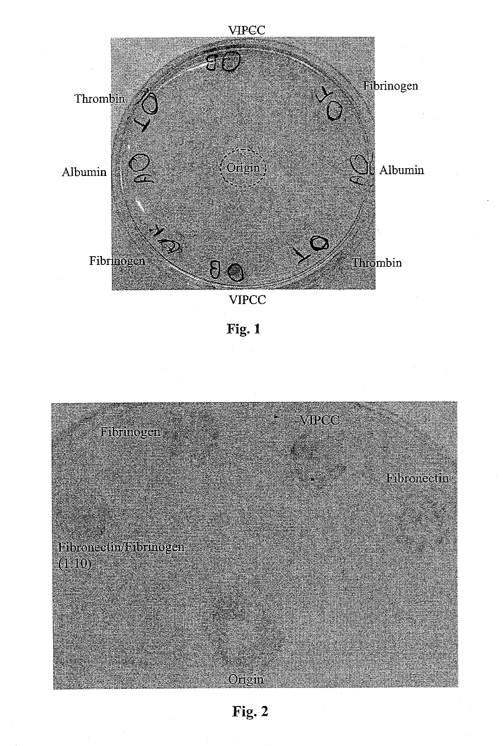 Compositions Suitable for Treatment of Spinal Disease, Disorder or Condition