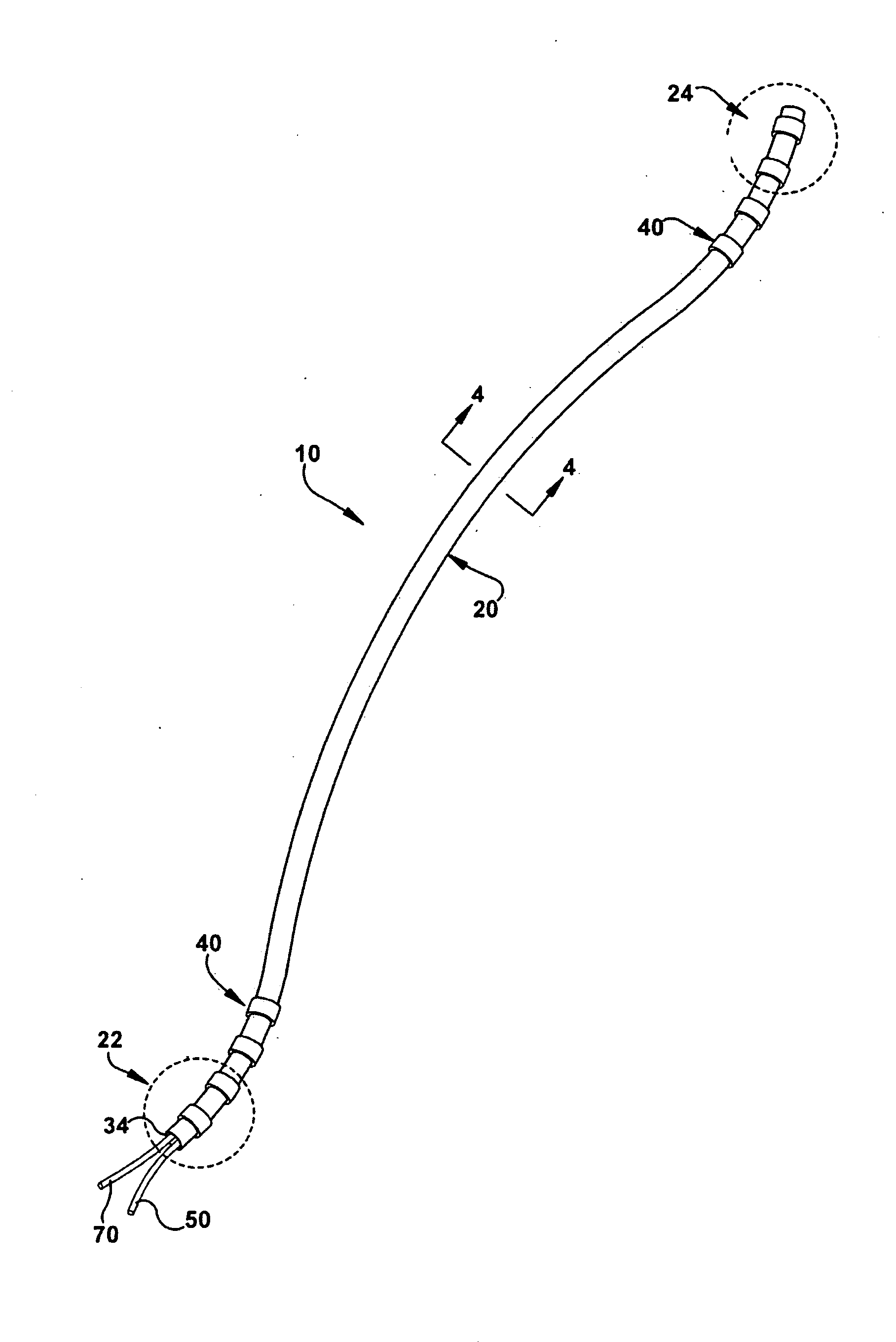 Method and apparatus for securing a neuromodulation lead to nervous tissue or tissue surrounding the nervous system