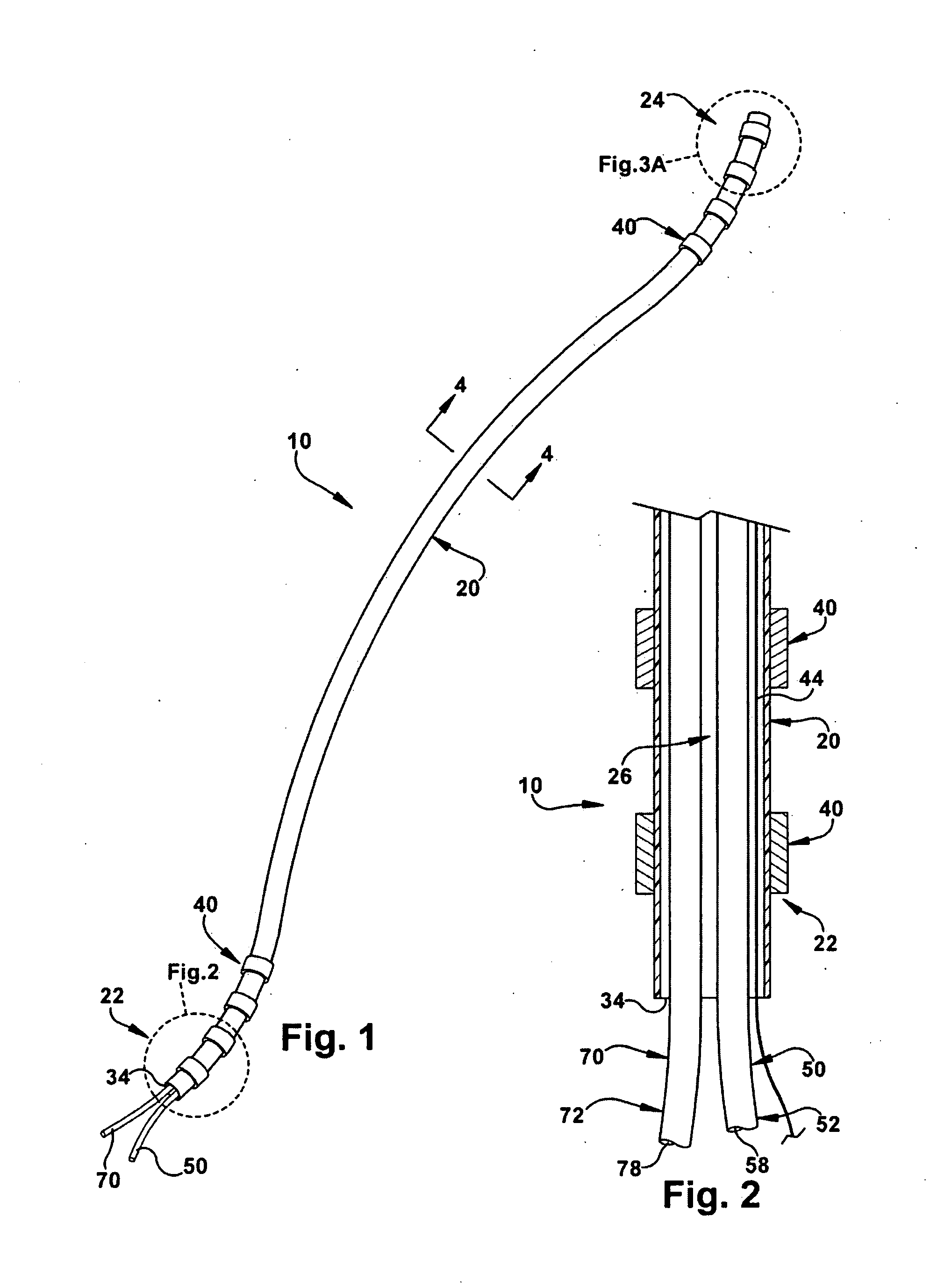 Method and apparatus for securing a neuromodulation lead to nervous tissue or tissue surrounding the nervous system