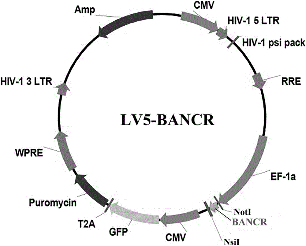 BANCR gene overexpression lentivirus vector, BANCR lentivirus, construction methods and application