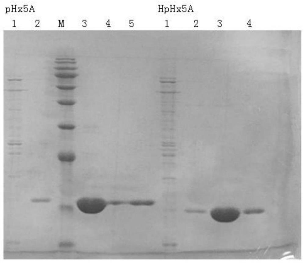 Single domain antibody and detection kit for human epidermal growth factor receptor 2 and application of single domain antibody