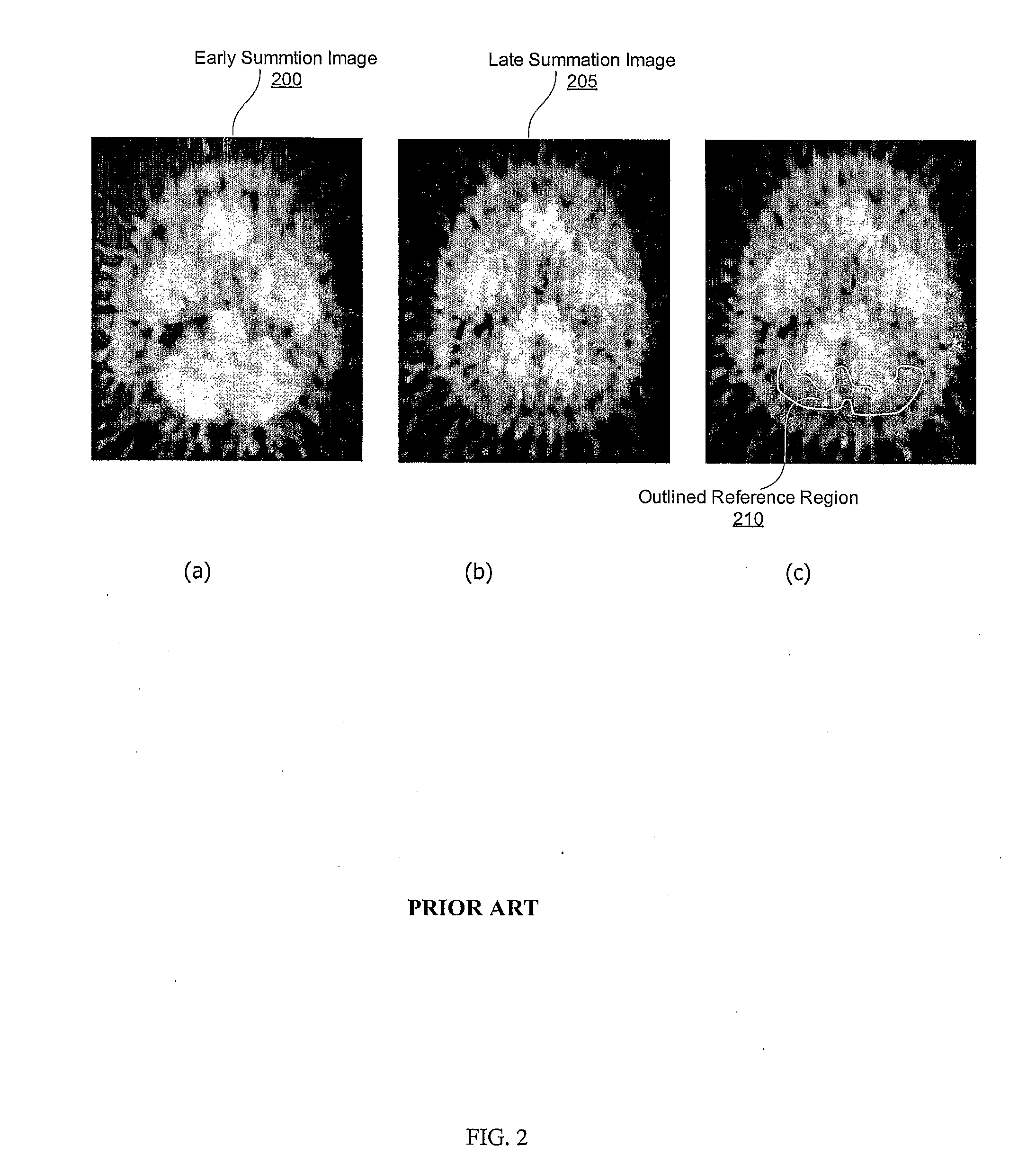 Method and system for outlining a region in positron emission tomography studies