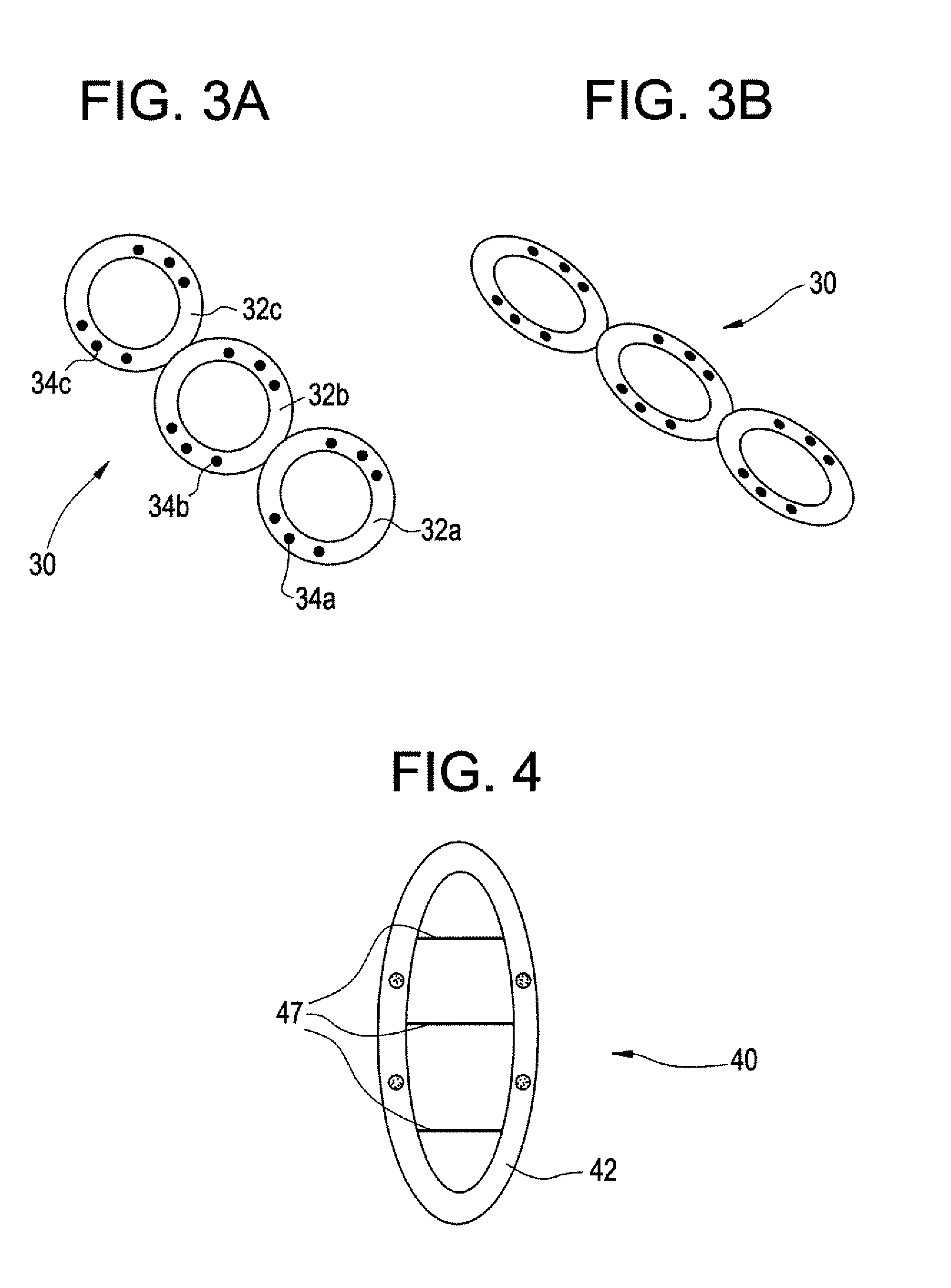 Intravesical drug delivery device and method