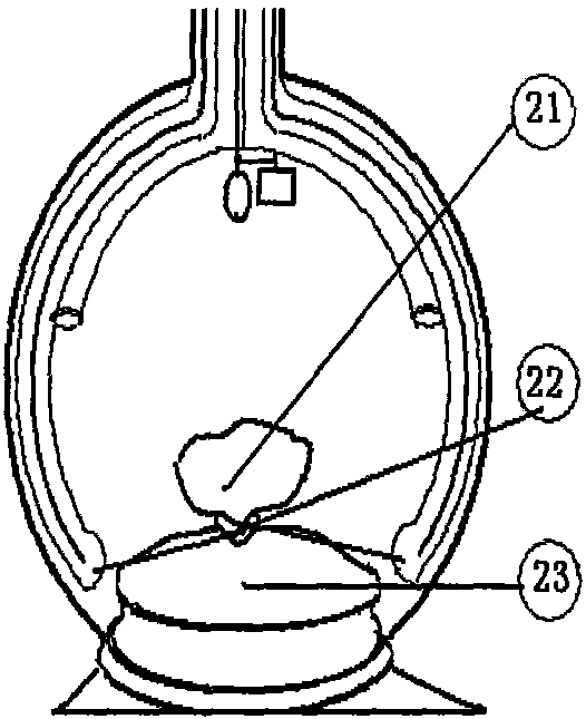 Self-healing tumor removal method and instrument