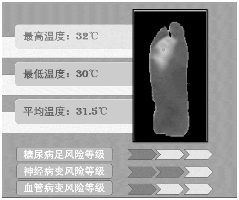 Diabetic foot image processing and risk early warning equipment based on infrared thermal imaging