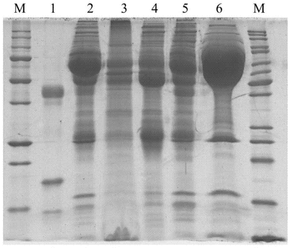 A kind of preparation method of 1-1 type human plasma haptoglobin extract