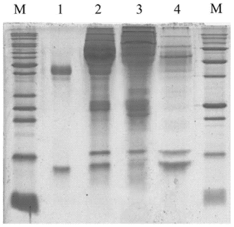 A kind of preparation method of 1-1 type human plasma haptoglobin extract