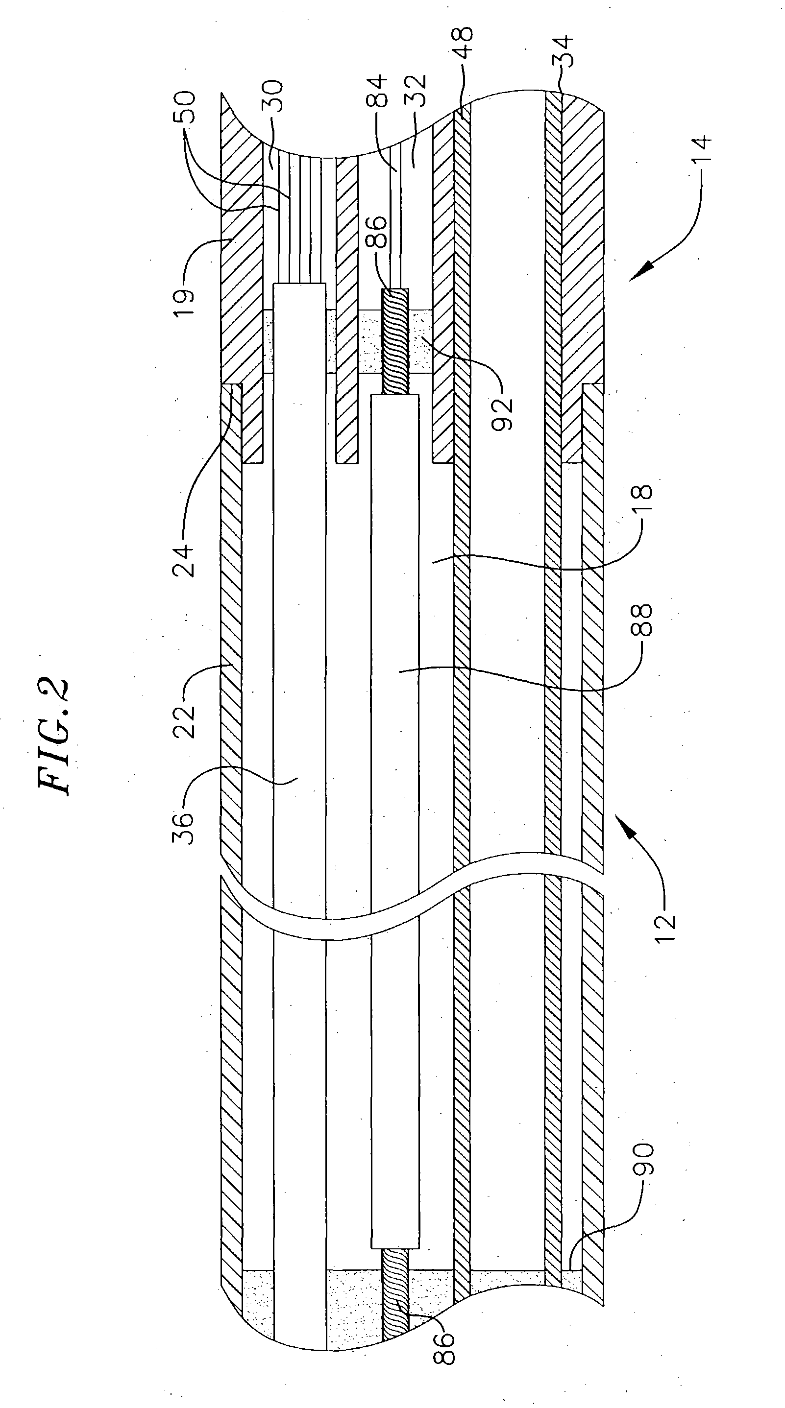 Enhanced ablation and mapping catheter and method for treating atrial fibrillation
