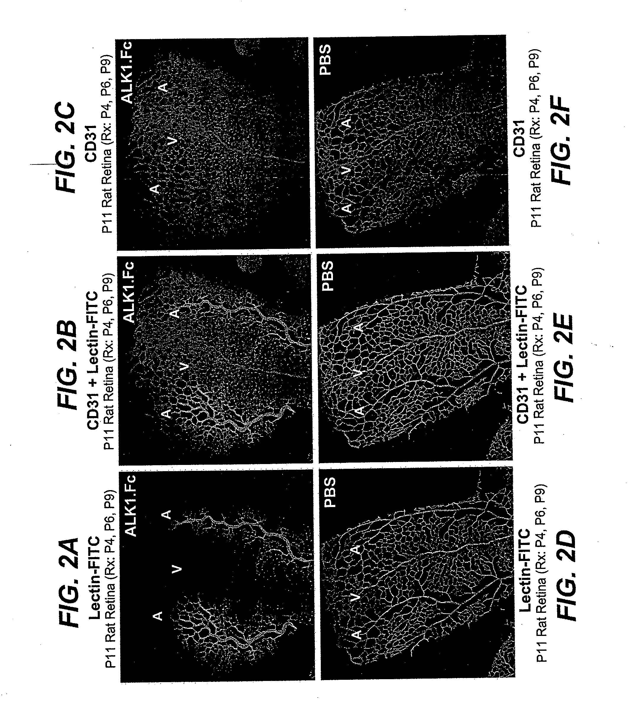 Activin receptor-like kinase-1 compositions and methods of use