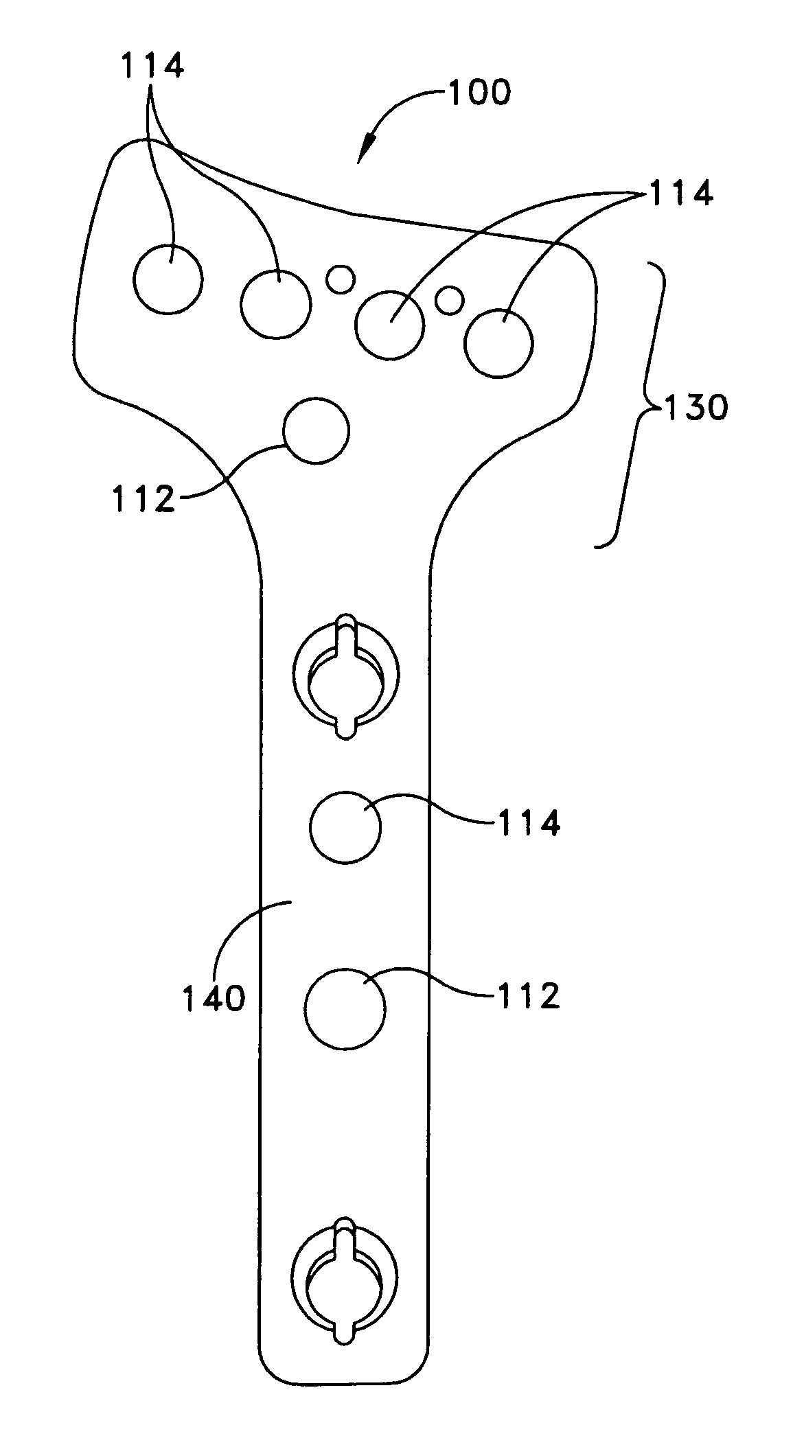 Distal radius bone plating system with locking and non-locking screws