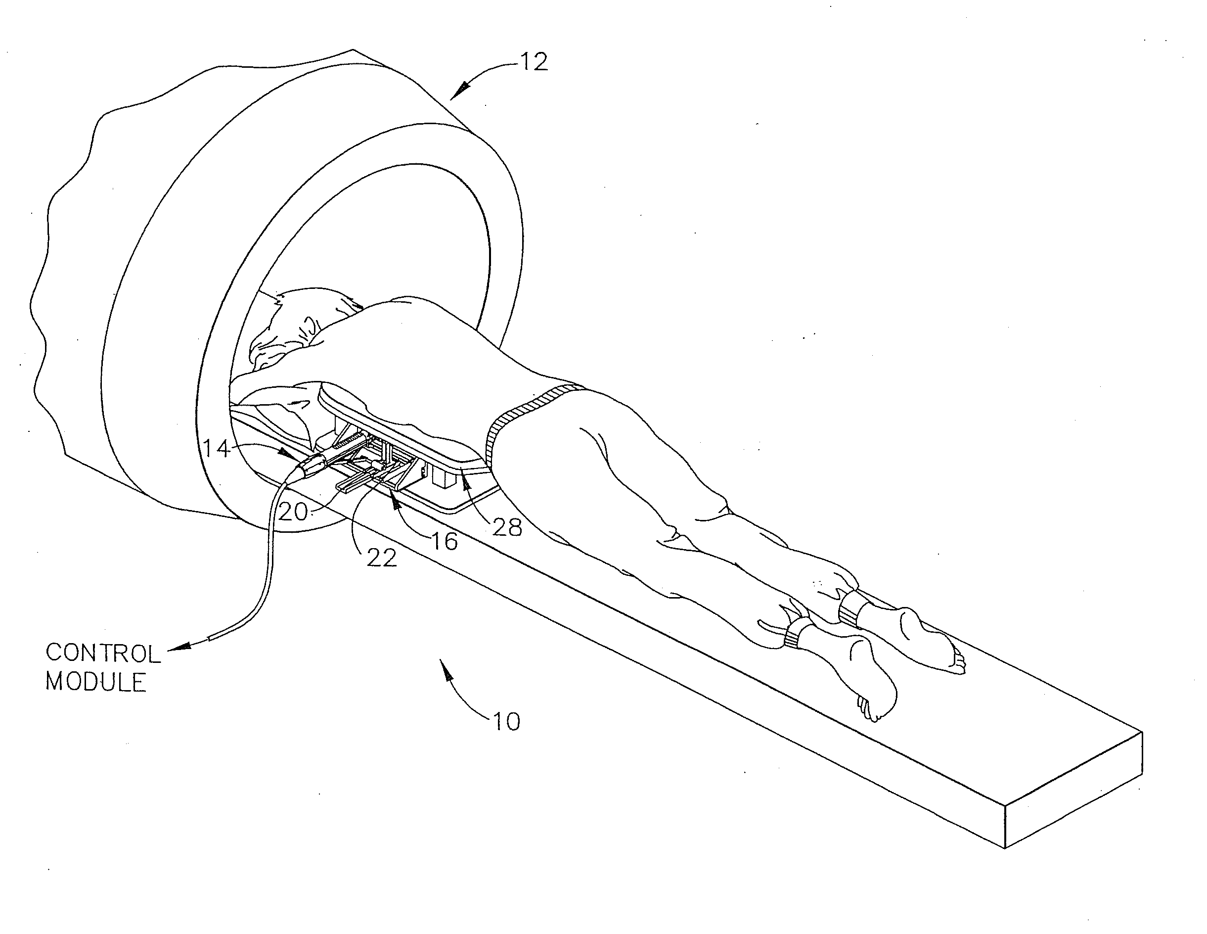 Breast compression assembly for use in MRI biopsy procedure