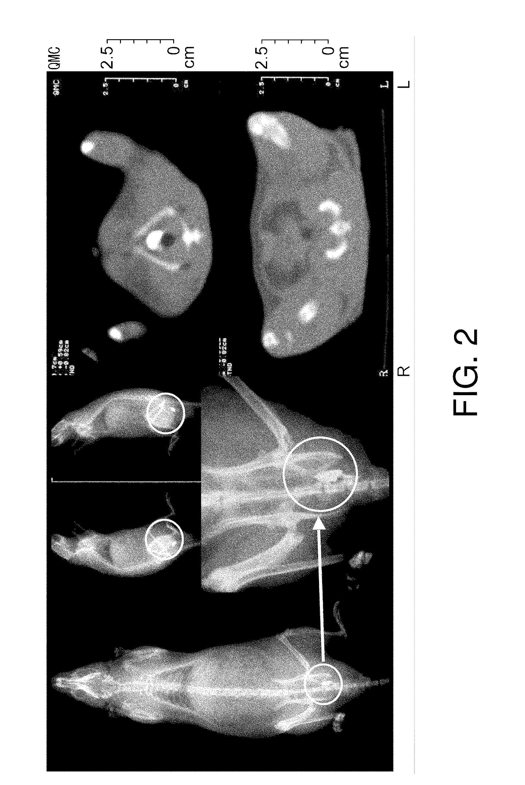 Method of fixing and expressing physiologically active substance