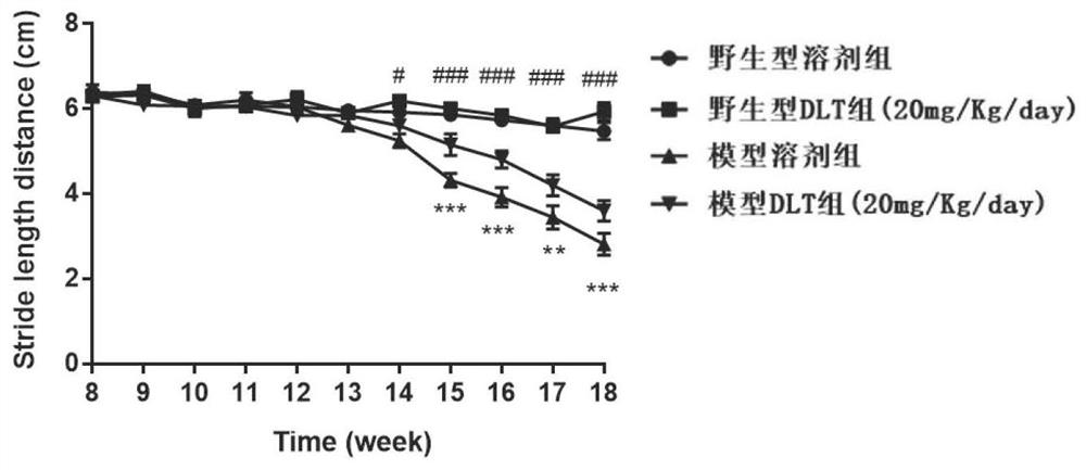 Application of Desloratadine and salts thereof in preparation of drugs for treating neurodegenerative diseases related to dyskinesia