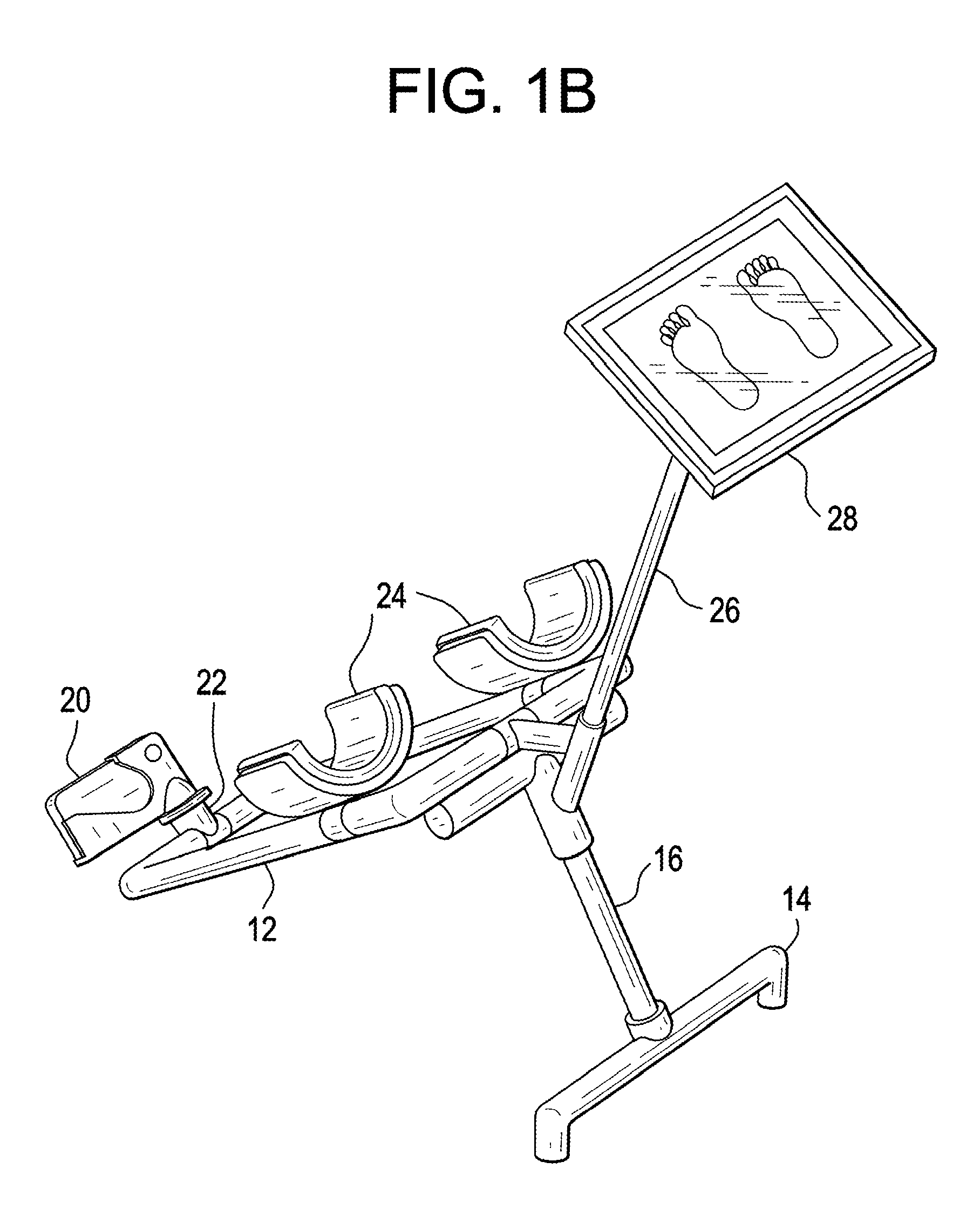 System for screening the skin condition of the plantar surface of the feet