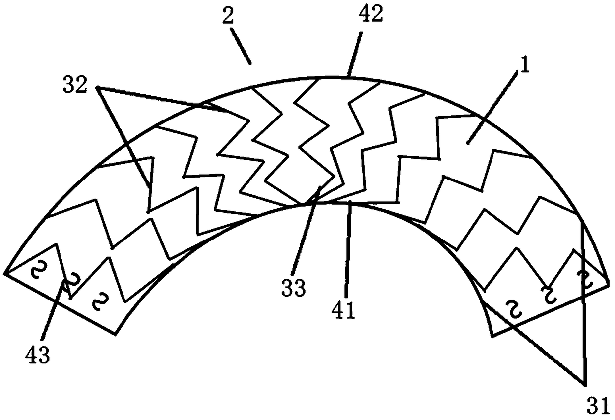 A covered stent