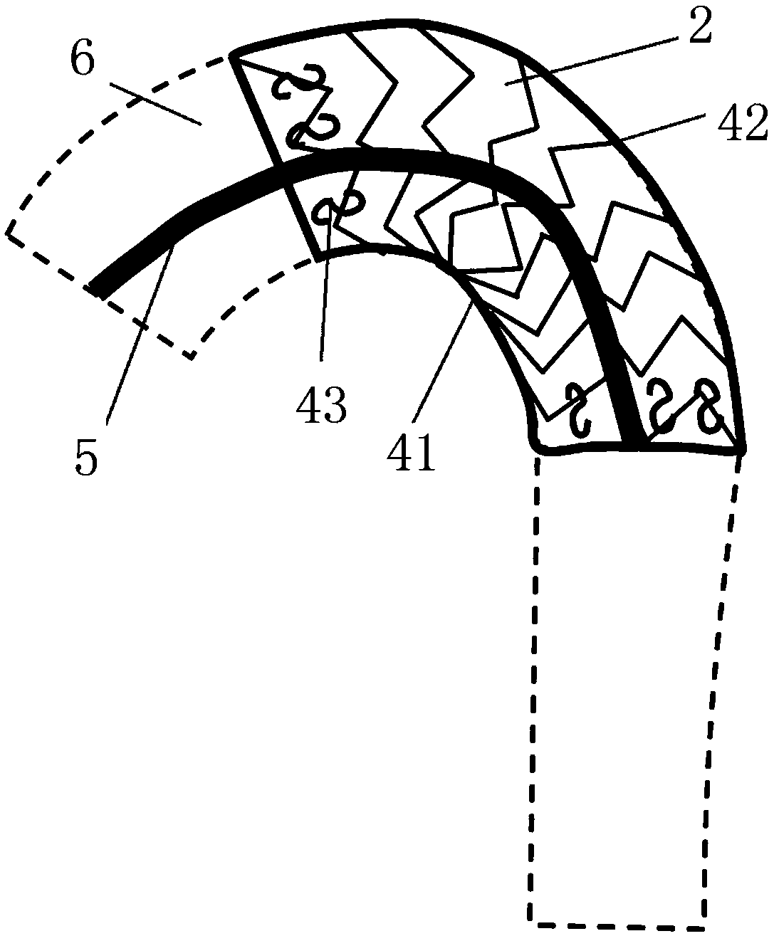 A covered stent