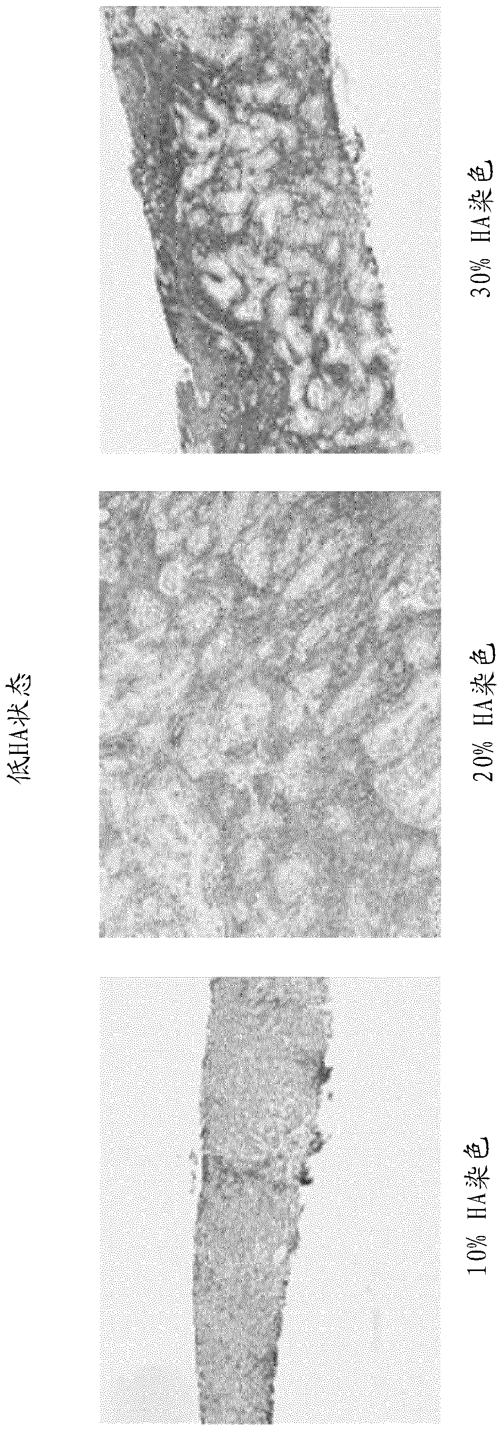 Methods and systems for scoring extracellular matrix biomarkers in tumor samples