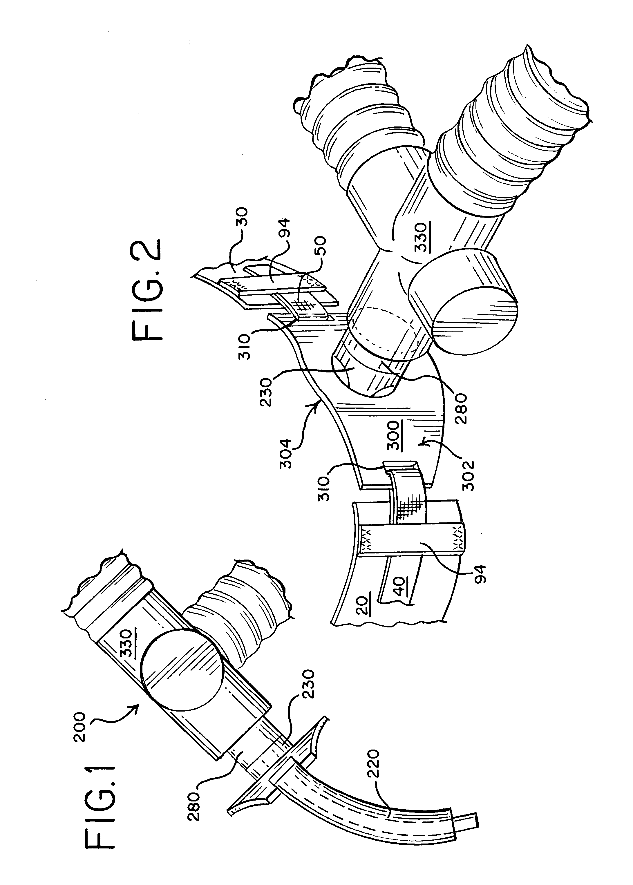 Tracheal tube anti-disconnect device
