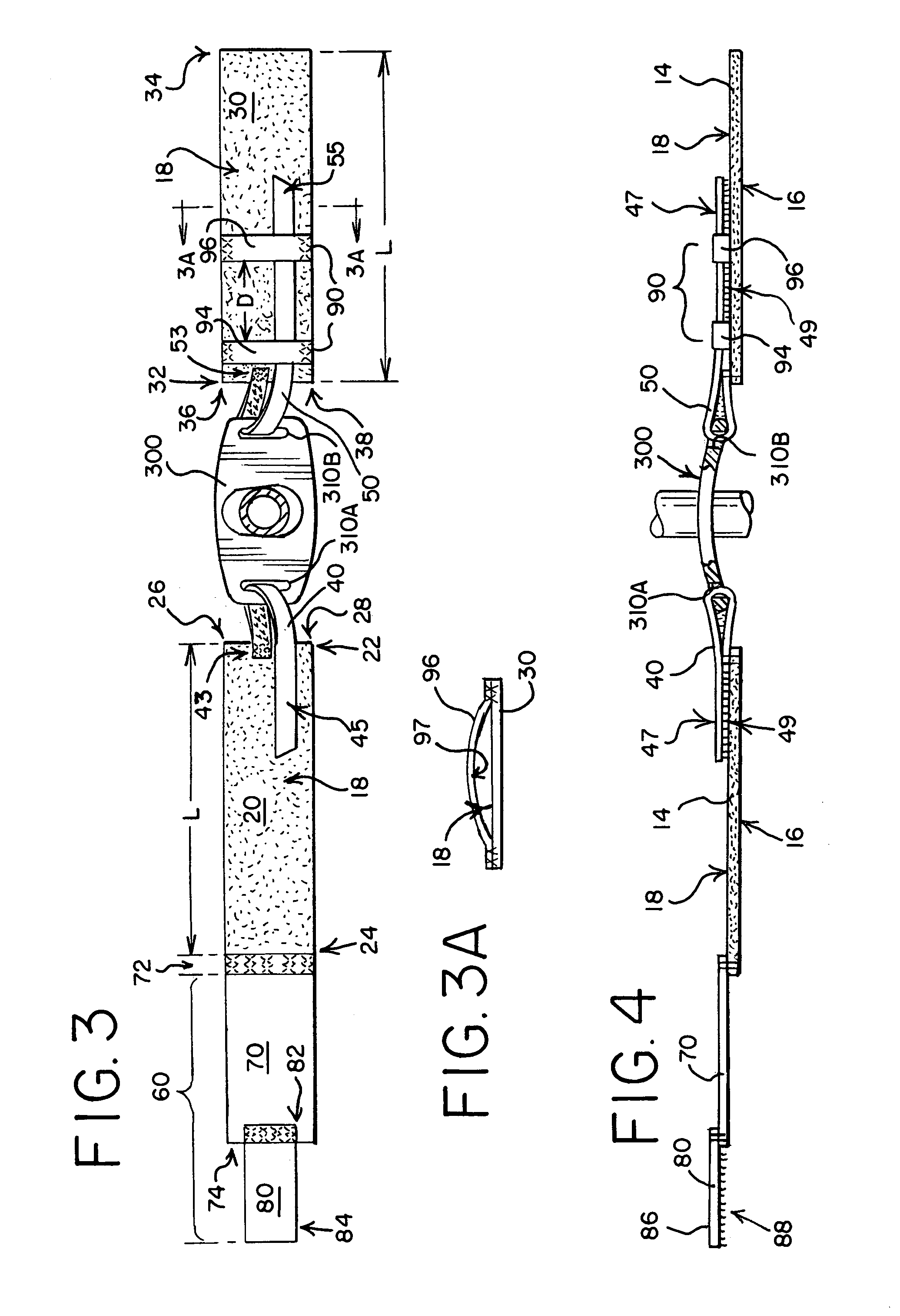 Tracheal tube anti-disconnect device