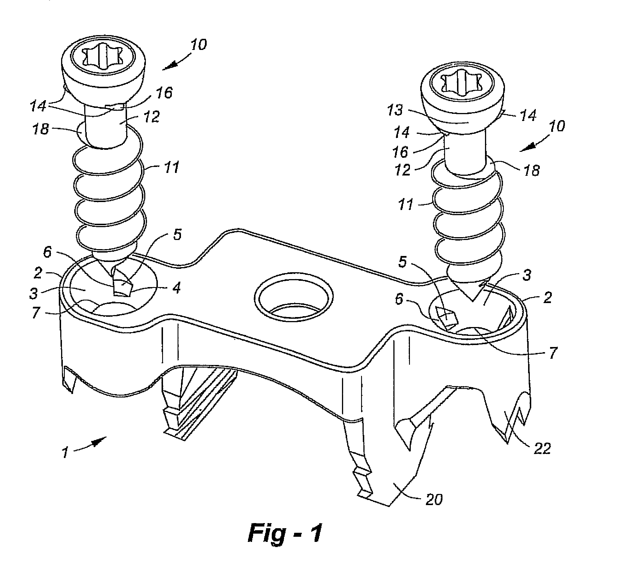 Implant with integral fastener retention