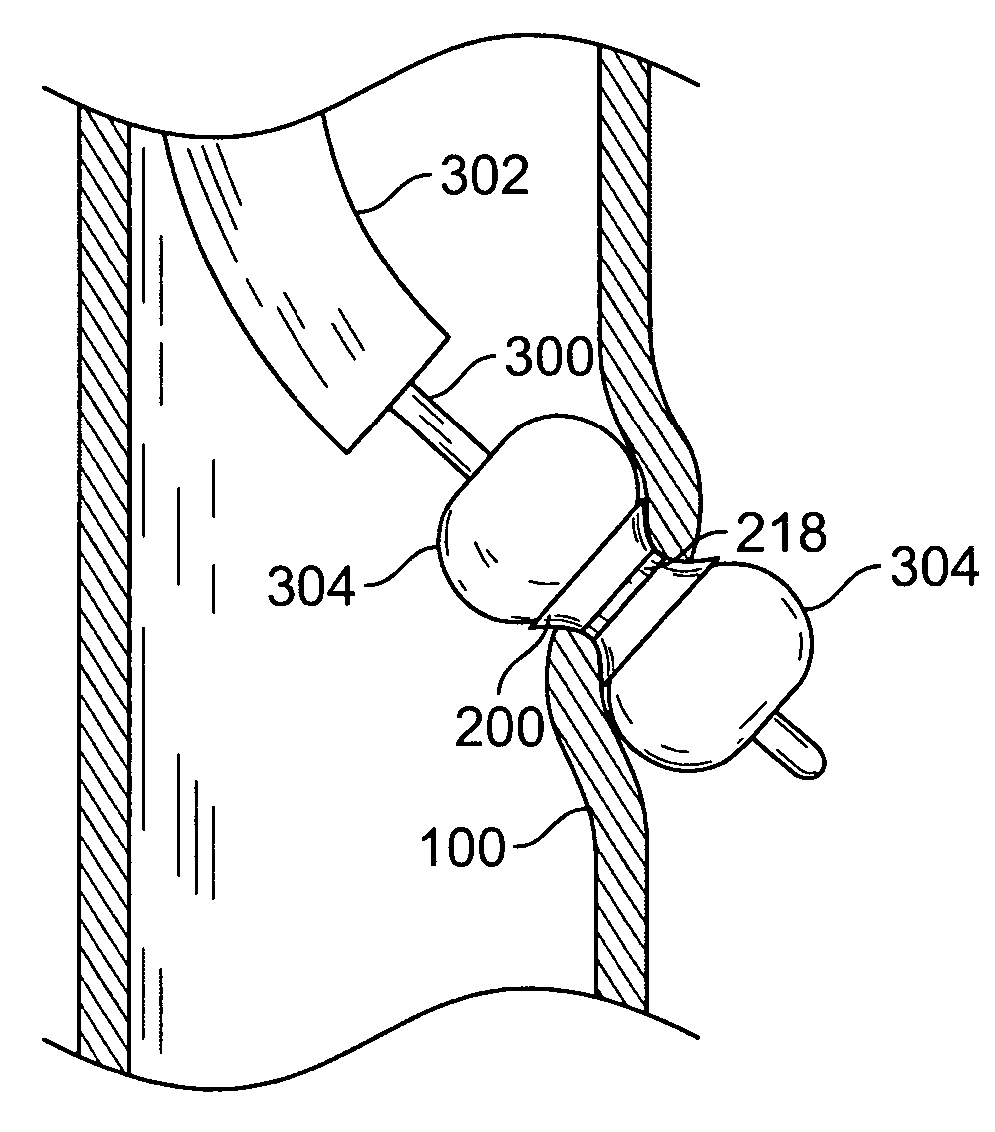 Methods and devices for maintaining surgically created channels in a body organ