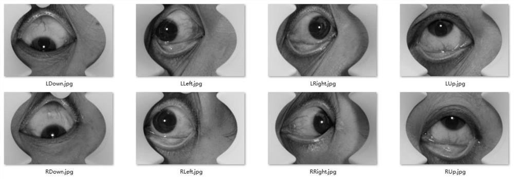 Information association method for eye image and symptom information