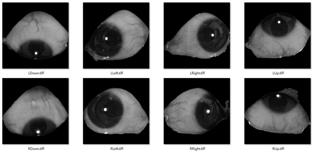 Information association method for eye image and symptom information