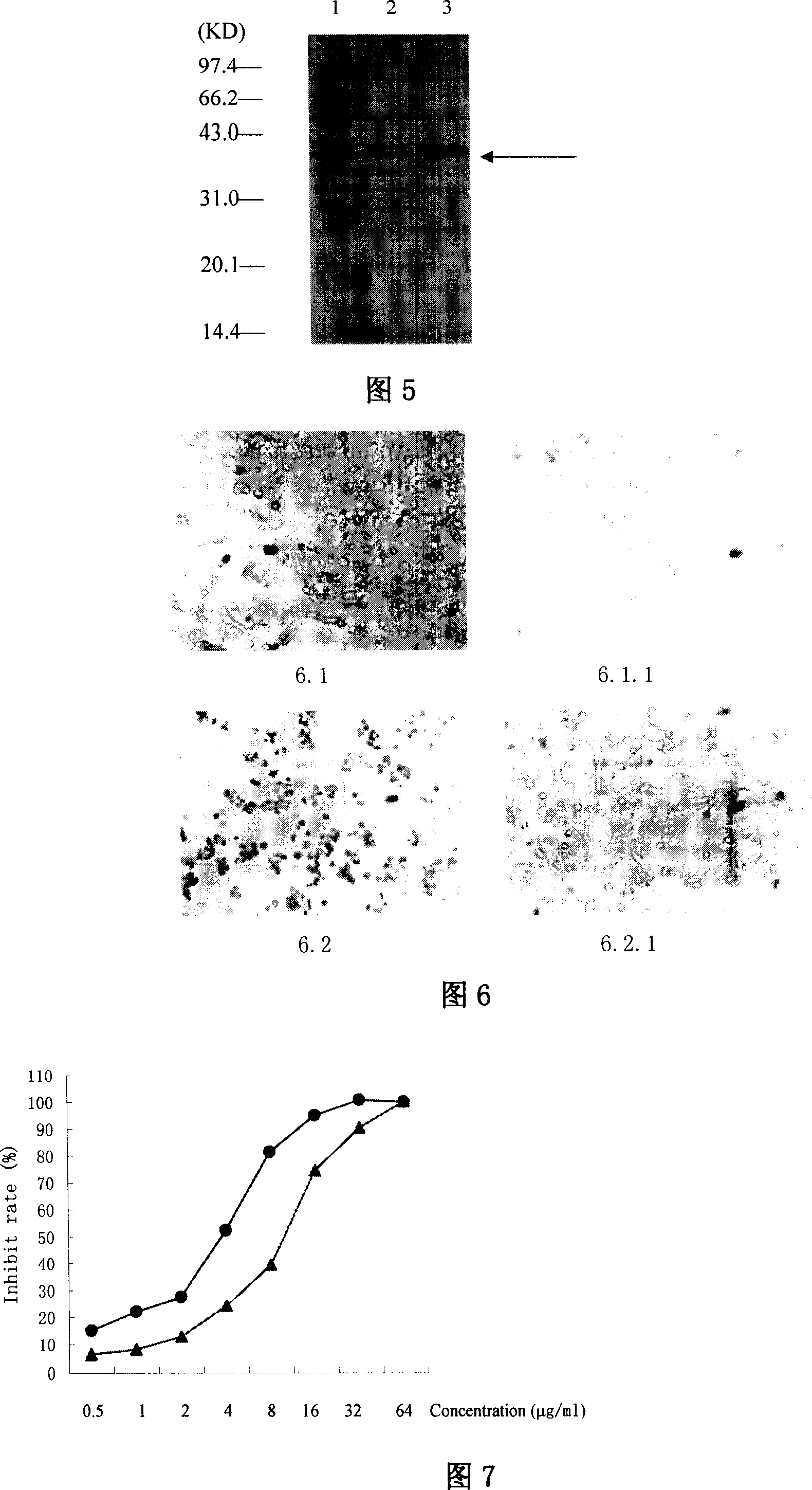 Recombined diphtheria toxin, preparation method, and application