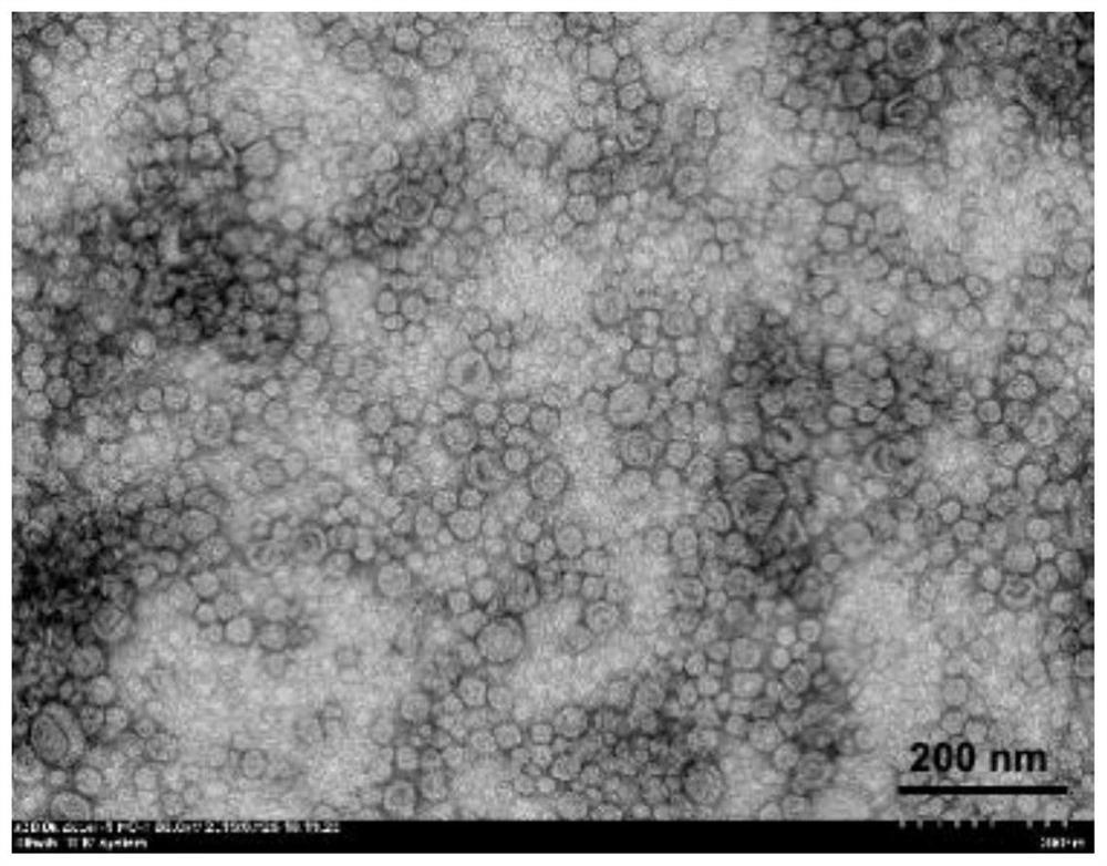 Nanoparticles of calcium carbonate-polydopamine coated drug-loaded bacterial outer membrane vesicles as well as preparation method and application of nanoparticles of calcium carbonate-polydopamine coated drug-loaded bacterial outer membrane vesicles