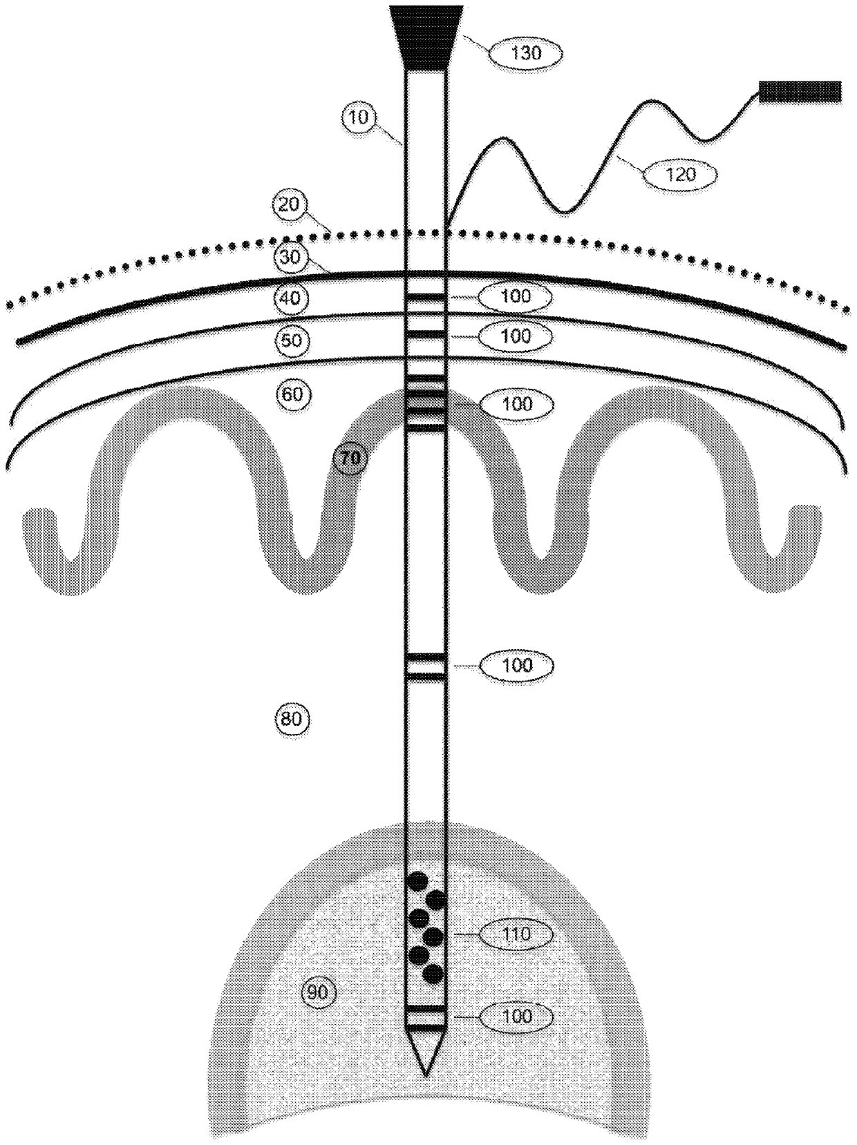 Systems and methods for positioning an intracranial device using brain activity