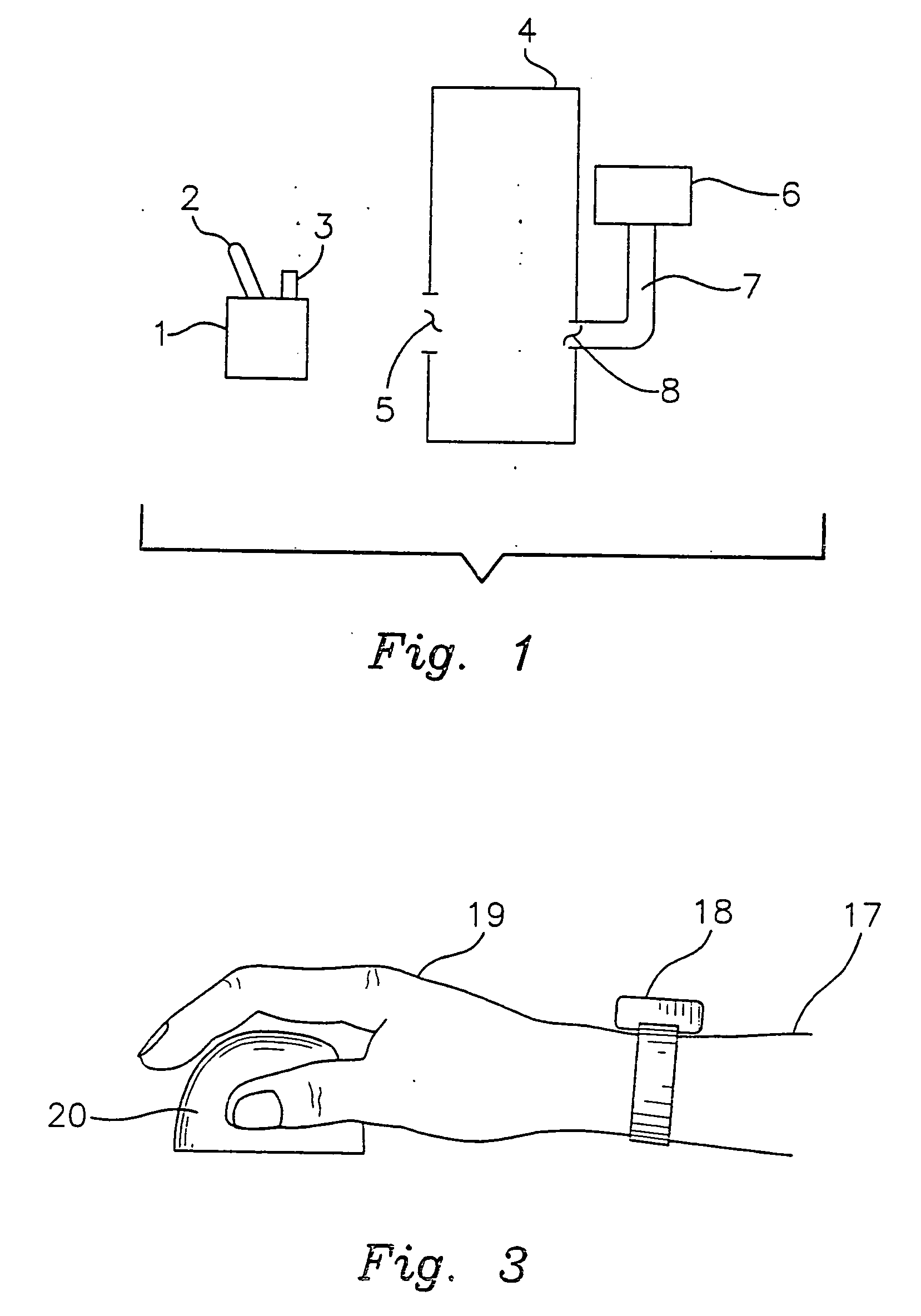 Prevention of repetitive motion injury