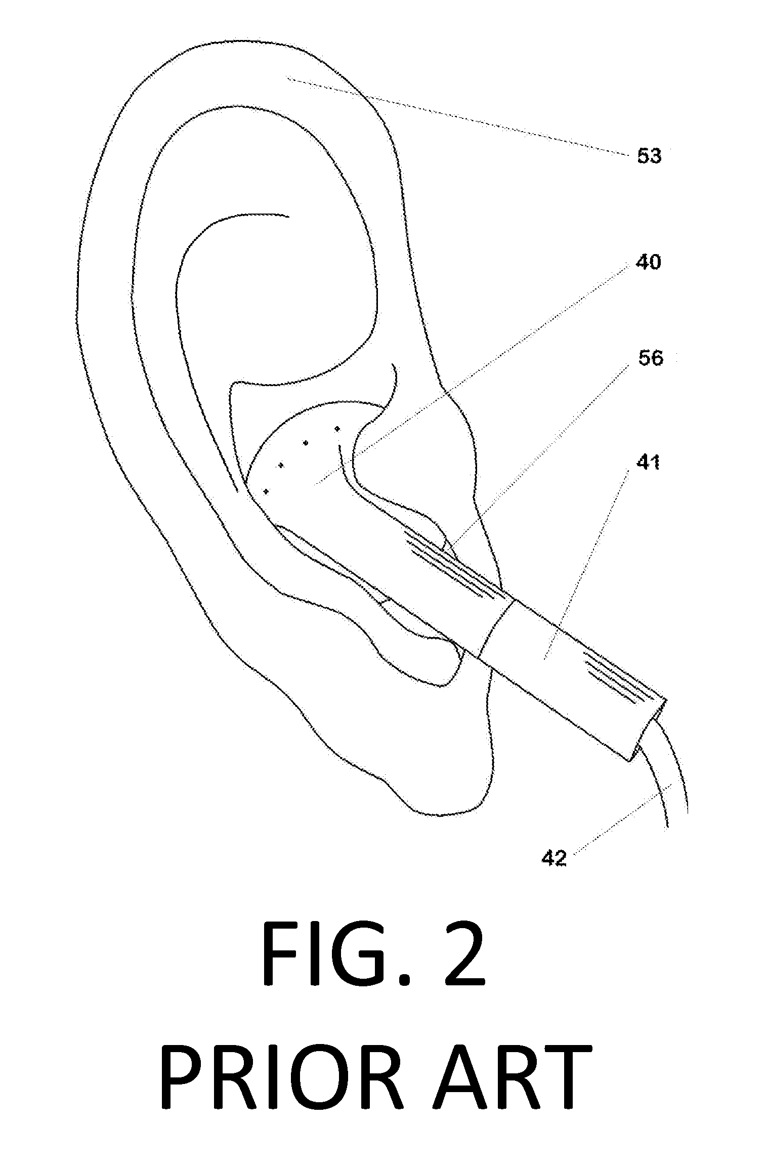 Earbud Positioning Device