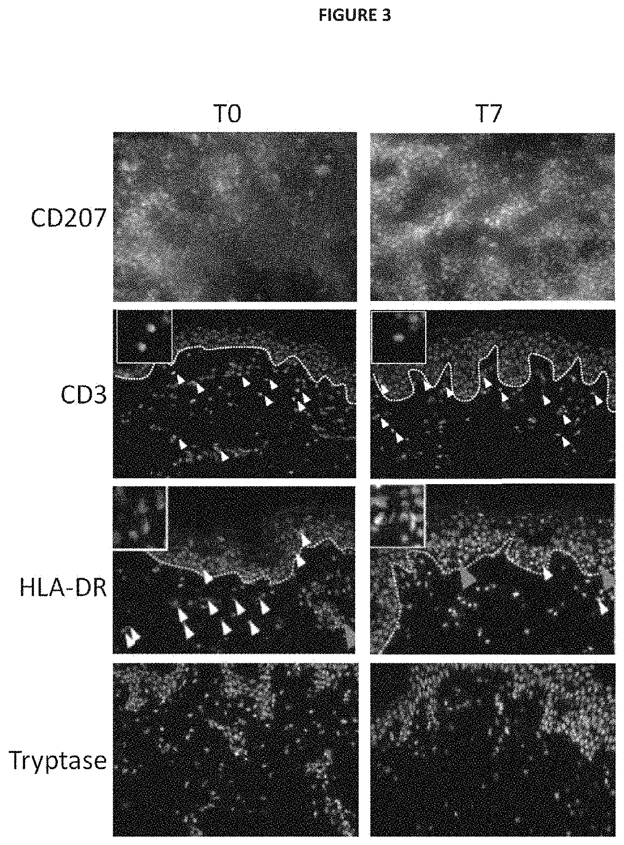 Ex vivo model of inflamed human skin and uses thereof for screening Anti-inflammatory compounds
